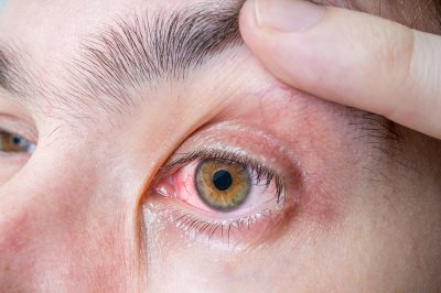 Eye Problems and Their Symptoms post thumbnail image